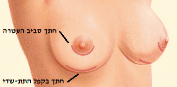 breast enlargement cuts